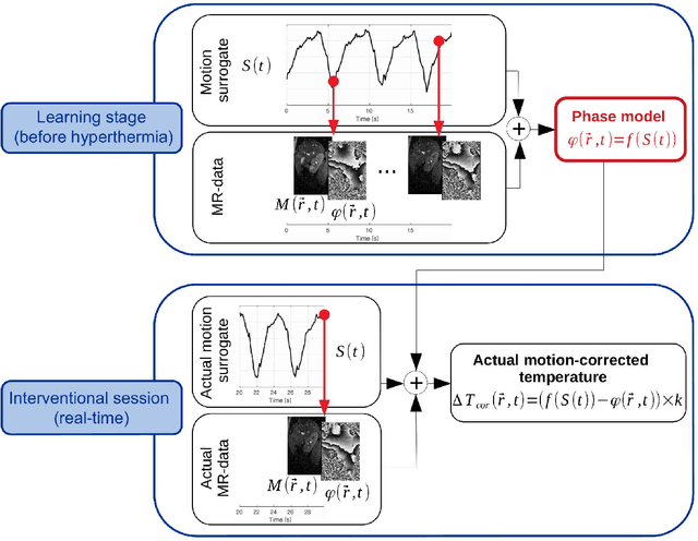 Figure 1 for Deep correction of breathing-related artifacts in MR-thermometry