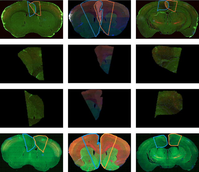 Figure 4 for Separating Overlapping Tissue Layers from Microscopy Images