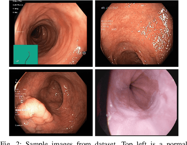 Figure 4 for Gastrointestinal Disorder Detection with a Transformer Based Approach