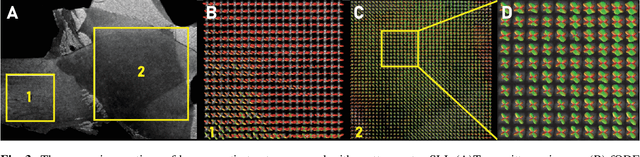 Figure 4 for GORDA: Graph-based ORientation Distribution Analysis of SLI scatterometry Patterns of Nerve Fibres