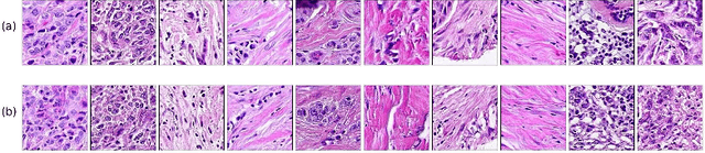 Figure 2 for Learning a low dimensional manifold of real cancer tissue with PathologyGAN