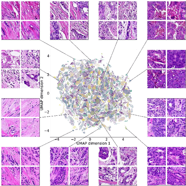 Figure 4 for Learning a low dimensional manifold of real cancer tissue with PathologyGAN