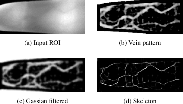 Figure 3 for FV-UPatches: Enhancing Universality in Finger Vein Recognition