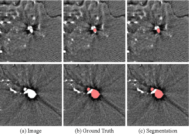 Figure 3 for Exploring Large Context for Cerebral Aneurysm Segmentation