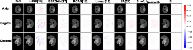 Figure 3 for Slice Imputation: Intermediate Slice Interpolation for Anisotropic 3D Medical Image Segmentation