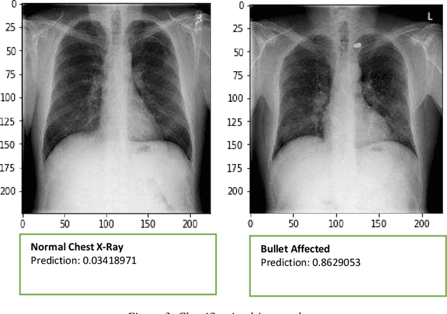 Figure 2 for Interpretation of Chest x-rays affected by bullets using deep transfer learning