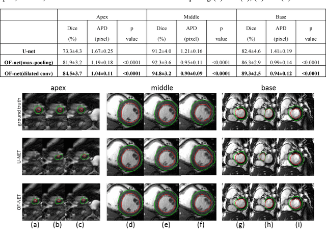 Figure 1 for Left Ventricle Segmentation via Optical-Flow-Net from Short-axis Cine MRI: Preserving the Temporal Coherence of Cardiac Motion