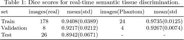 Figure 2 for EchoFusion: Tracking and Reconstruction of Objects in 4D Freehand Ultrasound Imaging without External Trackers