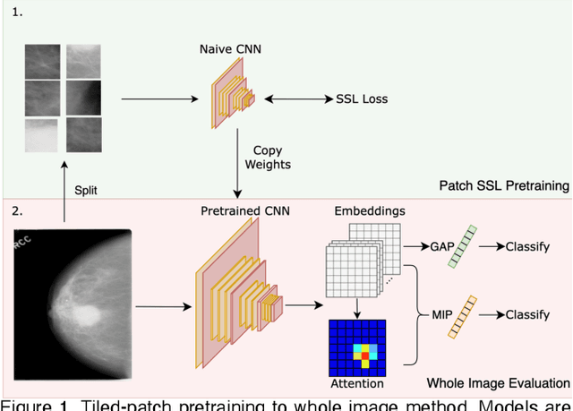 Figure 1 for Self-Supervised Deep Learning to Enhance Breast Cancer Detection on Screening Mammography