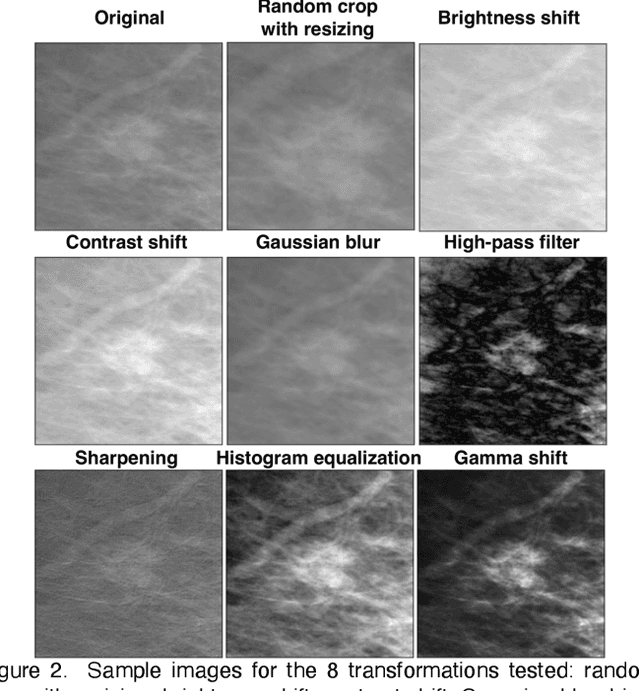 Figure 3 for Self-Supervised Deep Learning to Enhance Breast Cancer Detection on Screening Mammography