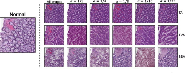 Figure 4 for Generative Image Translation for Data Augmentation in Colorectal Histopathology Images