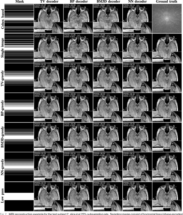 Figure 2 for Learning-Based Compressive MRI