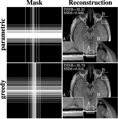Figure 3 for Learning-Based Compressive MRI