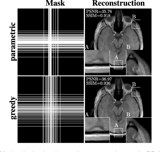 Figure 4 for Learning-Based Compressive MRI