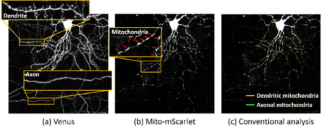 Figure 3 for MitoVis: A Visually-guided Interactive Intelligent System for Neuronal Mitochondria Analysis