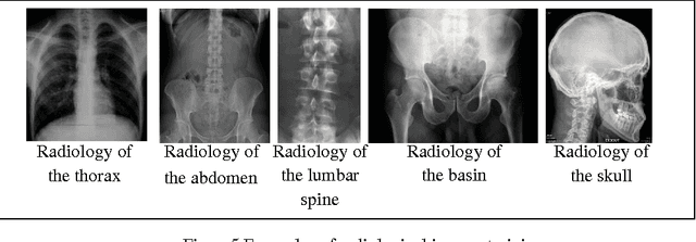 Figure 2 for Using a bag of Words for Automatic Medical Image Annotation with a Latent Semantic
