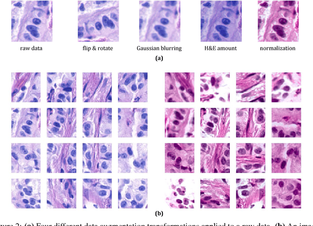 Figure 3 for Deep Learning with Permutation-invariant Operator for Multi-instance Histopathology Classification