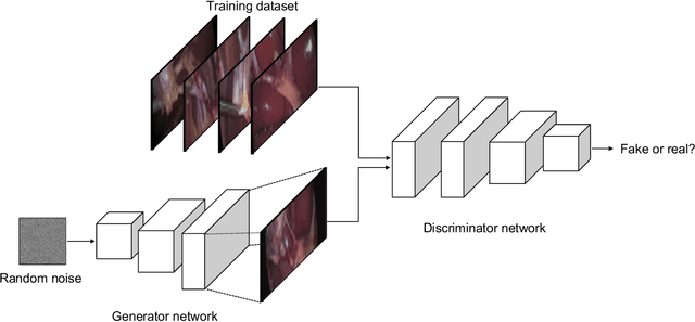 Figure 3 for Artificial Intelligence in Surgery: Neural Networks and Deep Learning