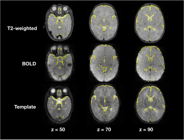 Figure 3 for NeoRS: a neonatal resting state fMRI data preprocessing pipeline