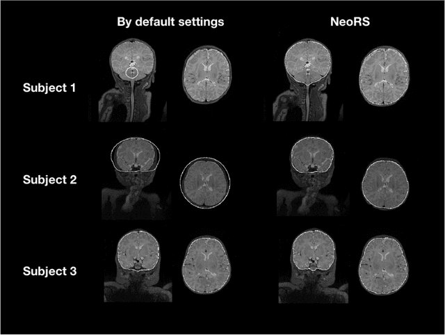 Figure 4 for NeoRS: a neonatal resting state fMRI data preprocessing pipeline