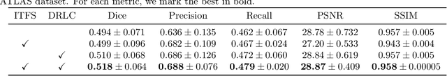 Figure 2 for Multi-task MR Imaging with Iterative Teacher Forcing and Re-weighted Deep Learning