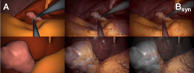 Figure 1 for Generating large labeled data sets for laparoscopic image processing tasks using unpaired image-to-image translation