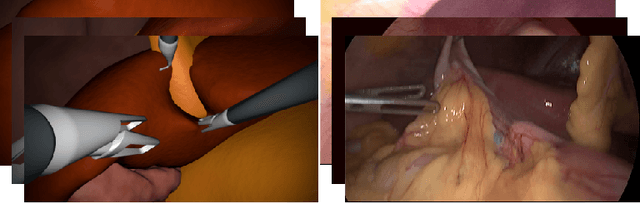 Figure 4 for Generating large labeled data sets for laparoscopic image processing tasks using unpaired image-to-image translation