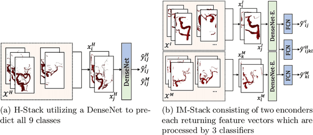 Figure 4 for Building Brains: Subvolume Recombination for Data Augmentation in Large Vessel Occlusion Detection