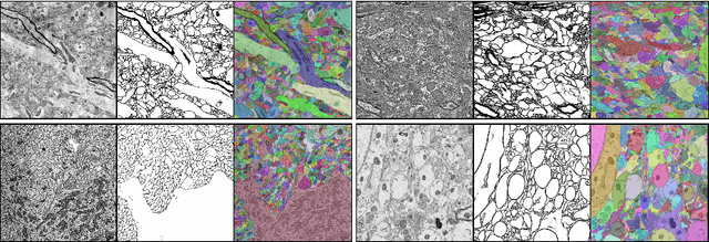 Figure 3 for RhoanaNet Pipeline: Dense Automatic Neural Annotation