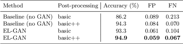 Figure 2 for EL-GAN: Embedding Loss Driven Generative Adversarial Networks for Lane Detection