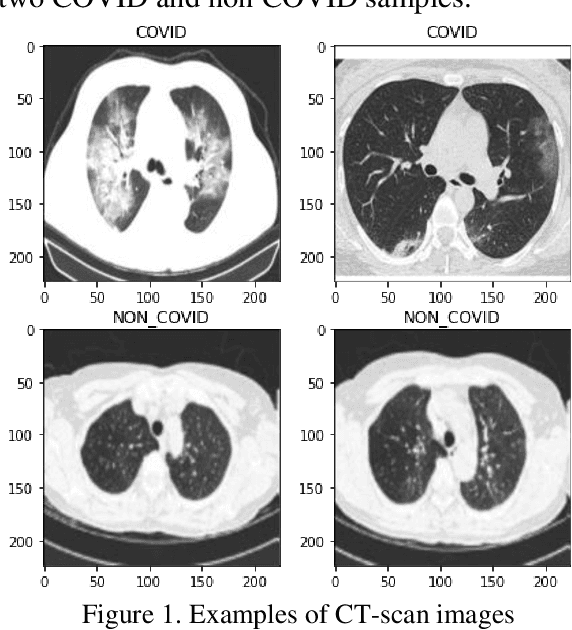 Figure 1 for A novel and reliable deep learning web-based tool to detect COVID-19 infection form chest CT-scan