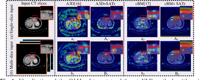 Figure 1 for SATr: Slice Attention with Transformer for Universal Lesion Detection