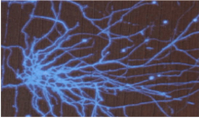 Figure 3 for A Comprehensive Survey with Quantitative Comparison of Image Analysis Methods for Microorganism Biovolume Measurements