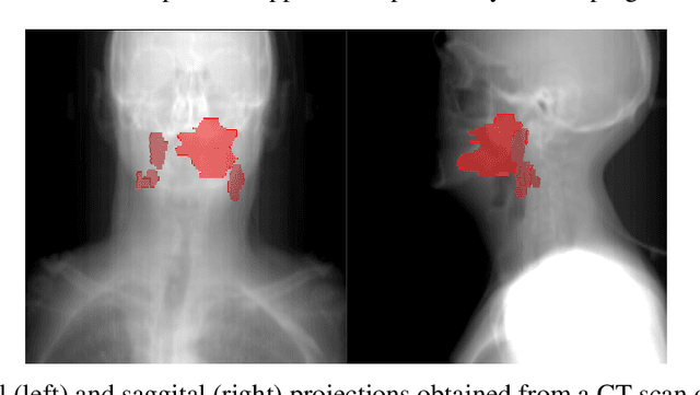 Figure 1 for Lymph Node Graph Neural Networks for Cancer Metastasis Prediction