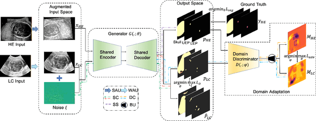 Figure 1 for A Dual Adversarial Calibration Framework for Automatic Fetal Brain Biometry