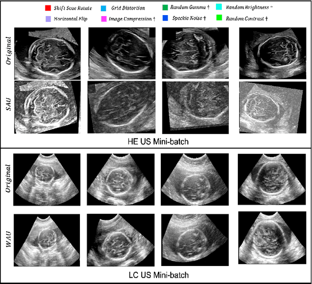 Figure 3 for A Dual Adversarial Calibration Framework for Automatic Fetal Brain Biometry