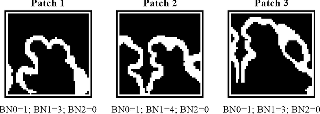 Figure 3 for Multi-dimensional topological loss for cortical plate segmentation in fetal brain MRI
