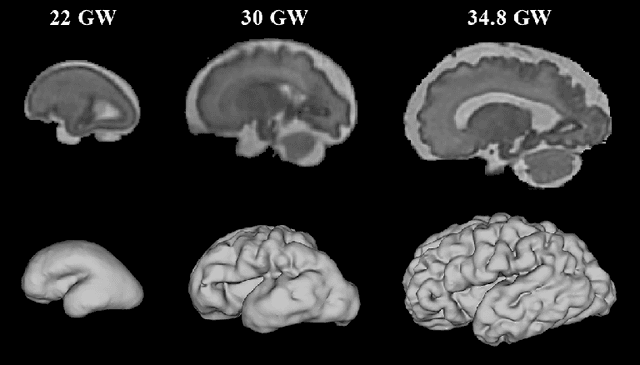 Figure 1 for Multi-dimensional topological loss for cortical plate segmentation in fetal brain MRI