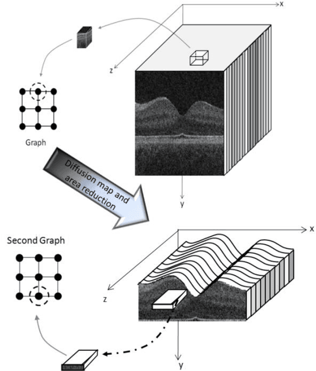 Figure 2 for Thickness Mapping of Eleven Retinal Layers in Normal Eyes Using Spectral Domain Optical Coherence Tomography