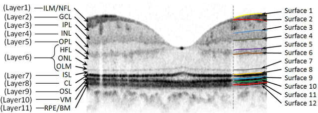 Figure 4 for Thickness Mapping of Eleven Retinal Layers in Normal Eyes Using Spectral Domain Optical Coherence Tomography