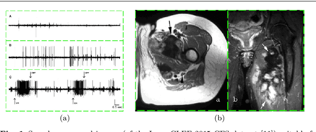 Figure 1 for Automatic Separation of Compound Figures in Scientific Articles