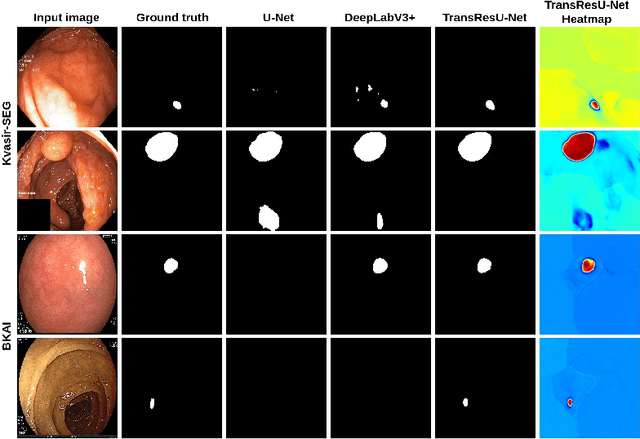 Figure 2 for TransResU-Net: Transformer based ResU-Net for Real-Time Colonoscopy Polyp Segmentation