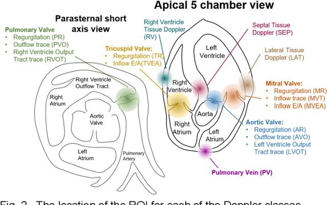 Figure 3 for Doppler Spectrum Classification with CNNs via Heatmap Location Encoding and a Multi-head Output Layer