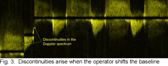 Figure 4 for User-Intended Doppler Measurement Type Prediction Combining CNNs With Smart Post-Processing