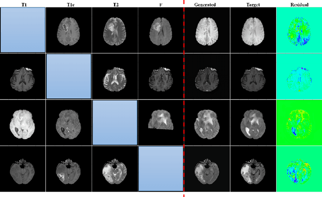 Figure 3 for MIST GAN: Modality Imputation Using Style Transfer for MRI