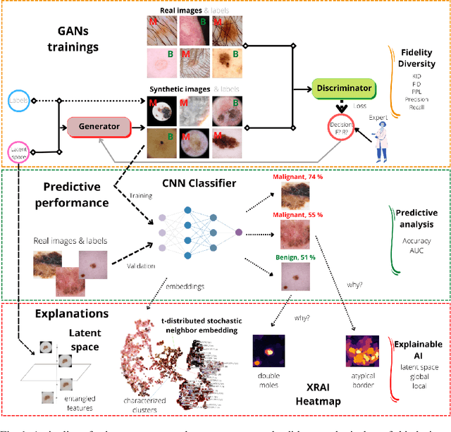 Figure 1 for GAN-based generative modelling for dermatological applications -- comparative study