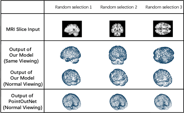 Figure 3 for A Point Cloud Generative Model via Tree-Structured Graph Convolutions for 3D Brain Shape Reconstruction