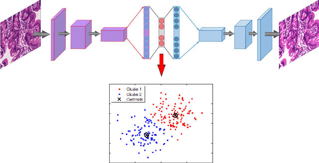 Figure 3 for Diagnosis of Celiac Disease and Environmental Enteropathy on Biopsy Images Using Color Balancing on Convolutional Neural Networks