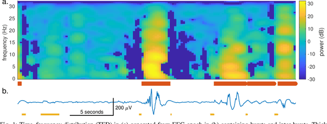 Figure 1 for Machine learning without a feature set for detecting bursts in the EEG of preterm infants
