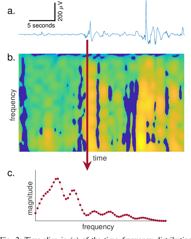 Figure 2 for Machine learning without a feature set for detecting bursts in the EEG of preterm infants